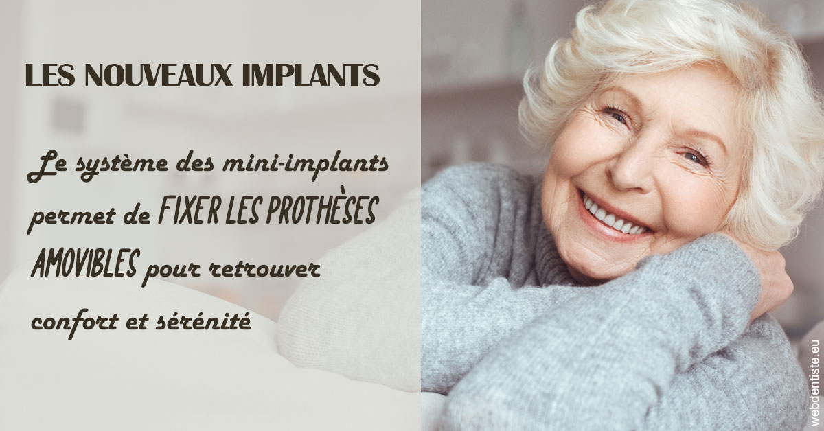 https://selarl-thierry-blanchot.chirurgiens-dentistes.fr/Les nouveaux implants 1