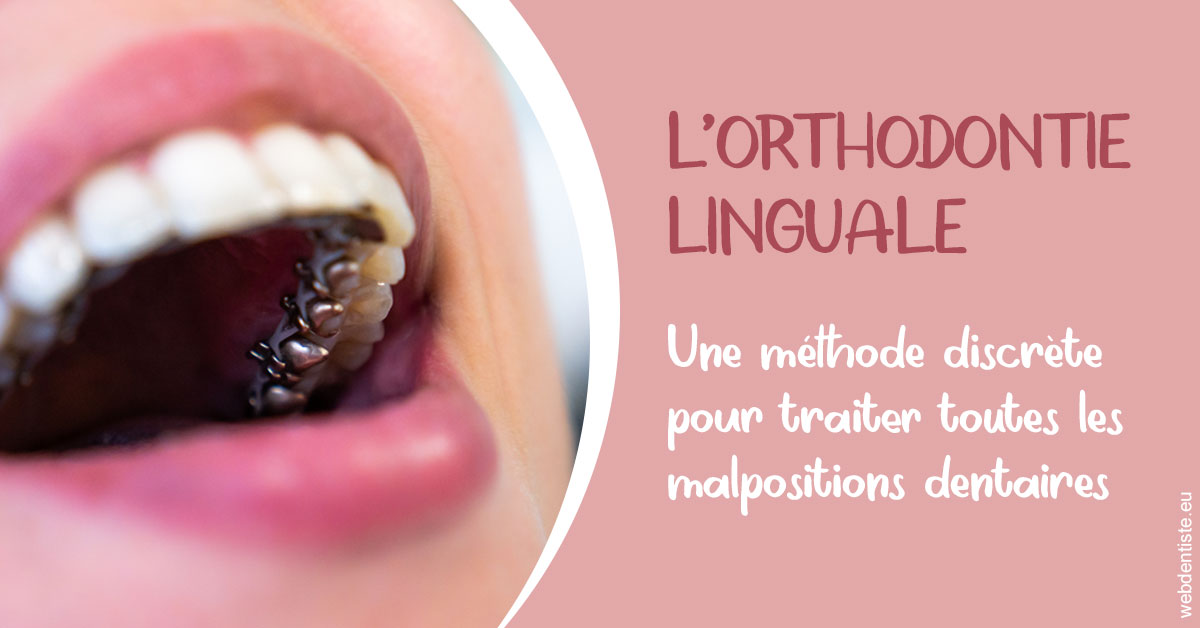https://selarl-thierry-blanchot.chirurgiens-dentistes.fr/L'orthodontie linguale 2