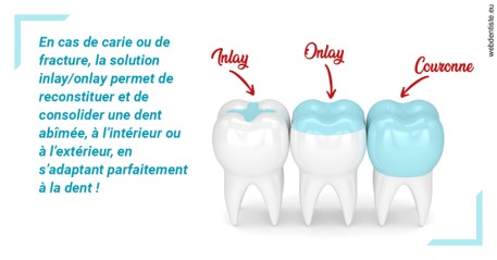 https://selarl-thierry-blanchot.chirurgiens-dentistes.fr/L'INLAY ou l'ONLAY