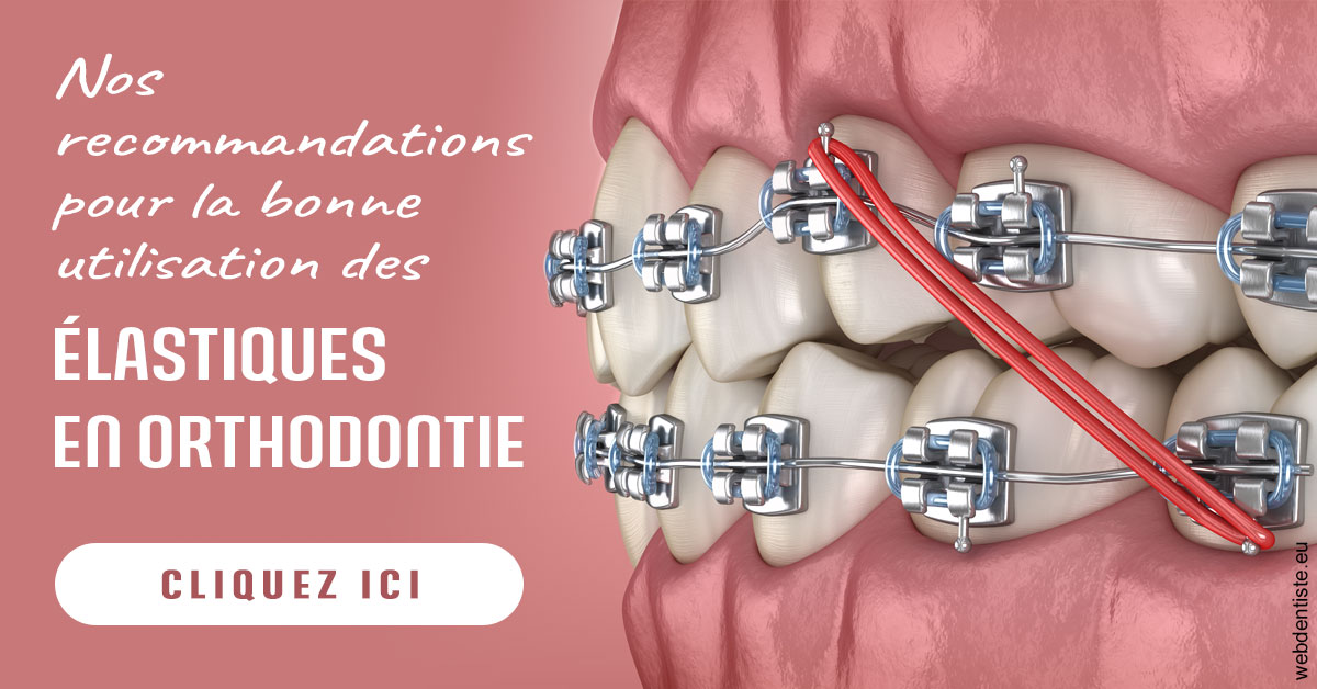 https://selarl-thierry-blanchot.chirurgiens-dentistes.fr/Elastiques orthodontie 2